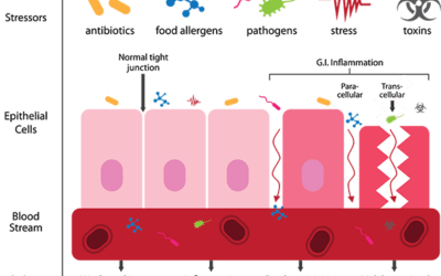 Leaky Gut and You: Part 3 of 3 – Leaky Gut and Autoimmune Diseases